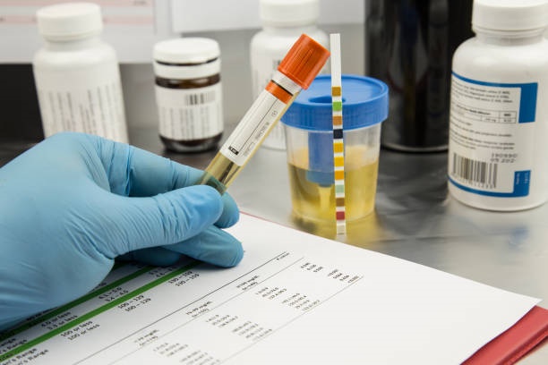 Imagem ilustrativa de Laboratório que faz exame toxicológico